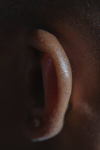 side ear
