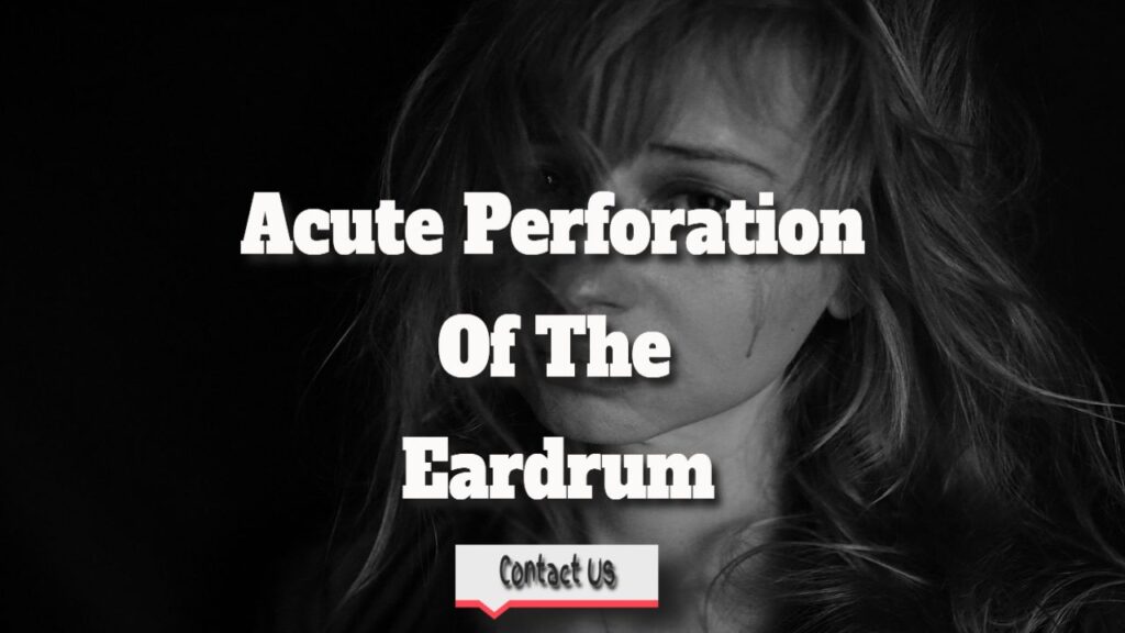 acute perforation of the eardrum