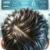 Apple Cider Vinegar Benefits for Scalp Health Explained
