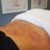 Sports Recovery Acupuncture: 6 Key Benefits You Need to Know